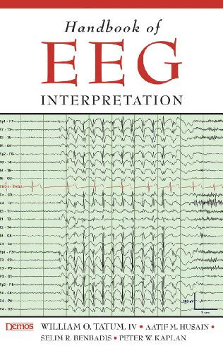 Handbook of EEG Interpretation Paperback S978