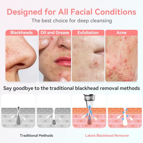 Blackhead Remover Pore Vacuum Electric Comedone Extractor Tool with 5 Suction Power and 5 Probes N286